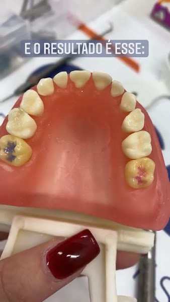 Foto 4 de Dentista Dra. Kelly Gracciotim | Odontopediatria