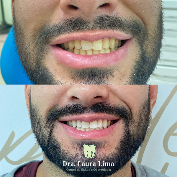 Foto 2 de Dentista Dra Laura Lima Clínica Odontológica Santa Terezinha Fazenda Rio Grande