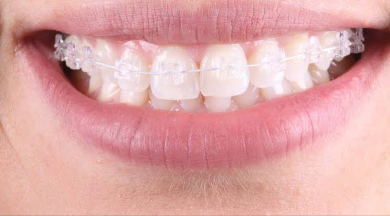 Foto 3 de Dentista - Dra Lohane Oliveira