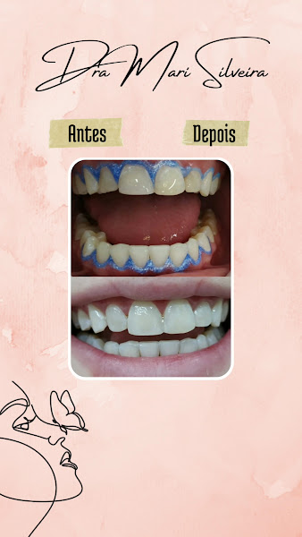 Foto 3 de Dentista Dra Marielle Silveira