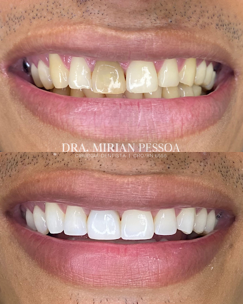 Foto 2 de Dentista - Dra Mirian Pessoa