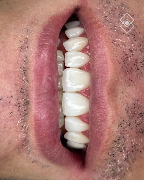 Foto 3 de Dentista - Dra Mirian Pessoa