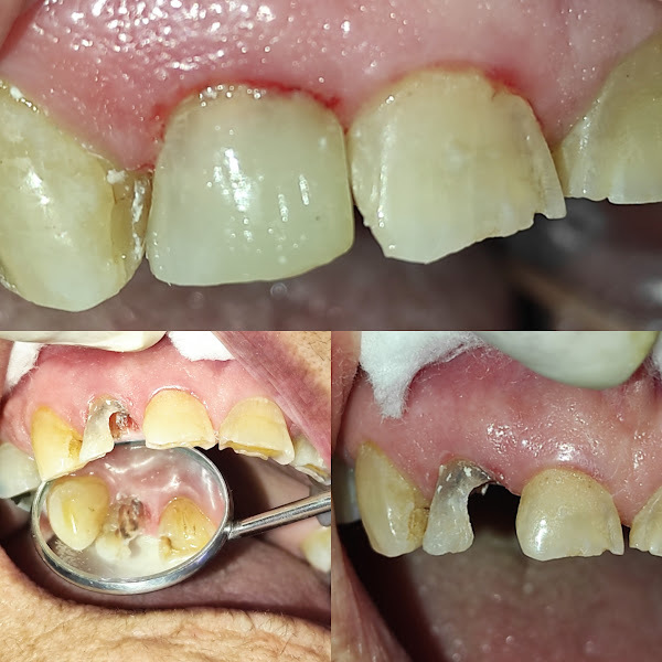 Foto 3 de Dentista Dra Mônica Ramos - MR Odontológia e Estética