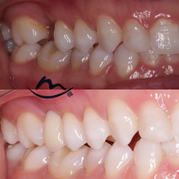 Foto 2 de Dentista Dra.Morgana Ferreira