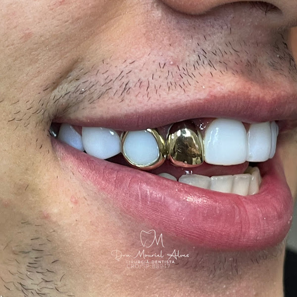 Foto 3 de Dentista - Dra. Mouriel Alves De Oliveira - Implantodontista