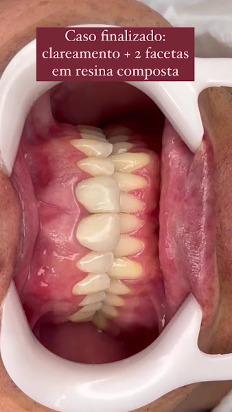 Foto 4 de Dentista Dra. Mylla Haag