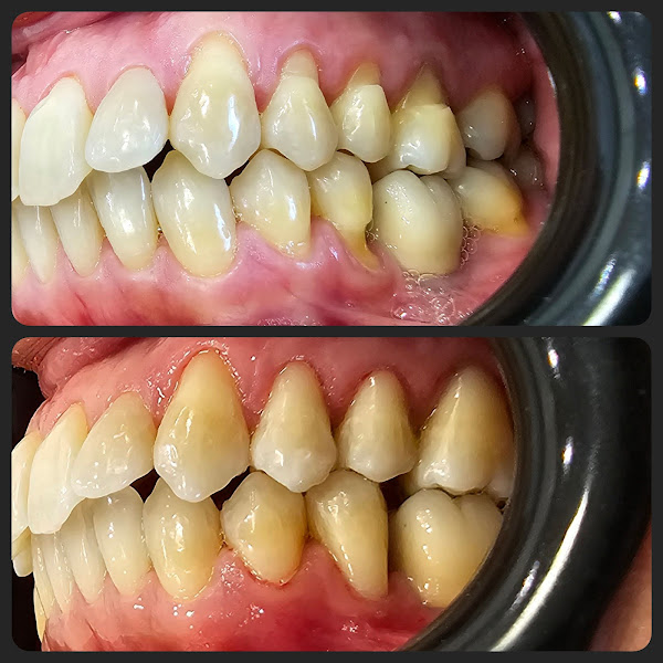 Foto 2 de Dentista - Dra Paloma Grasso - Vila Carrão