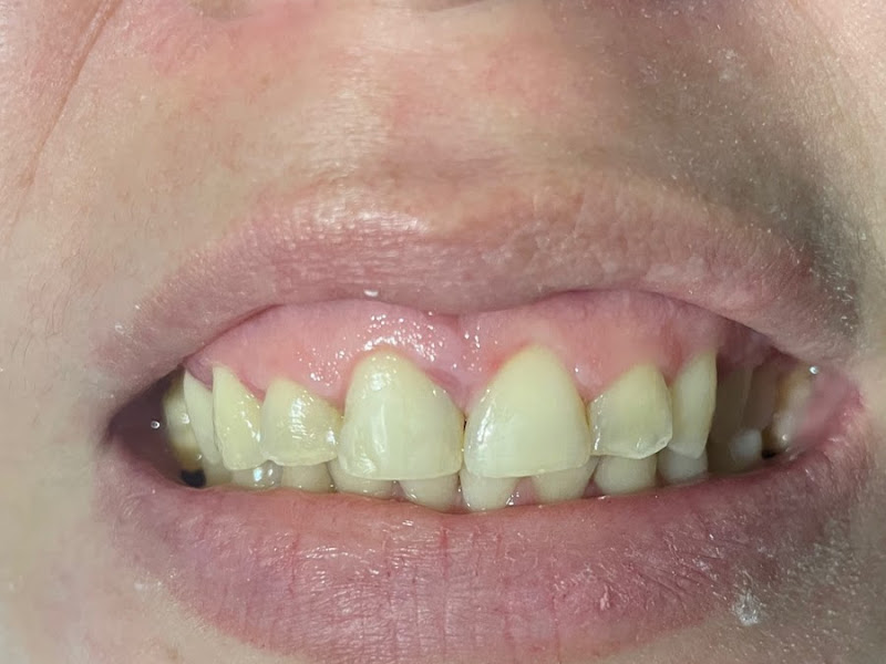 Foto 7 de Dentista Dra.Pauliana Cavalcante