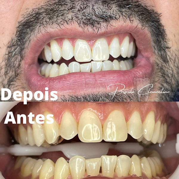 Foto 3 de Dentista - Dra . Priscila Clementino .