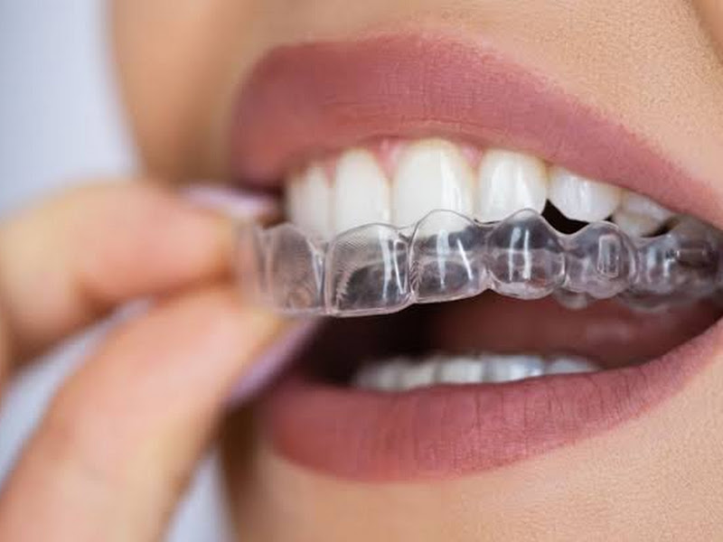 Foto 3 de Dentista Dra Regianne V. Marcelino