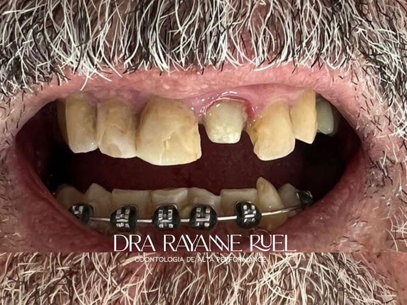 Foto 2 de Dentista Dra. Rosane Orlandini Carvalho