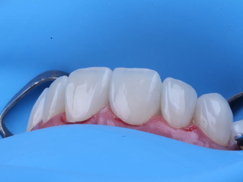 Foto 10 de Dentista Dra Sacha Felix