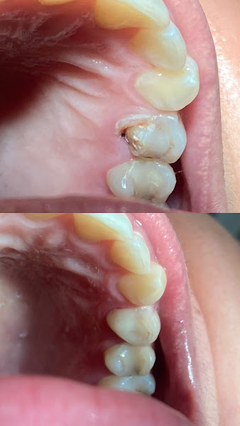 Foto 2 de Dentista | Dra. Tainara Moreno Gomes