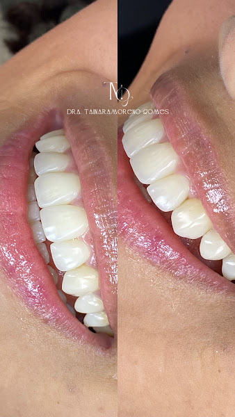 Foto 3 de Dentista | Dra. Tainara Moreno Gomes