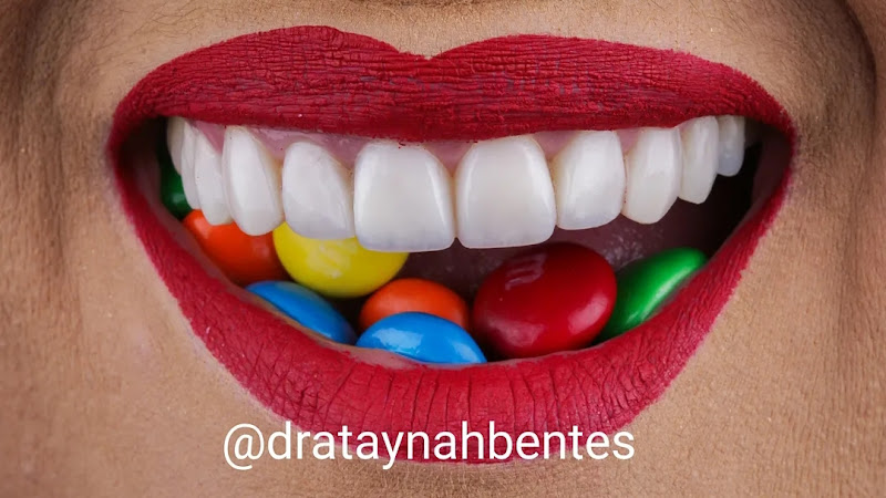 Foto 2 de Dentista Dra Taynah Bentes