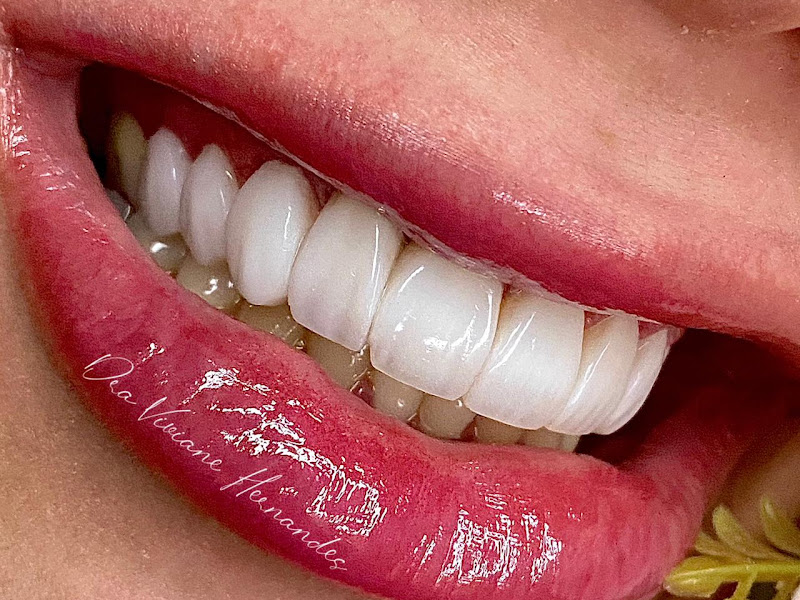 Foto 3 de Dentista - Dra. Terezinha N. Venturelli Gonçalves