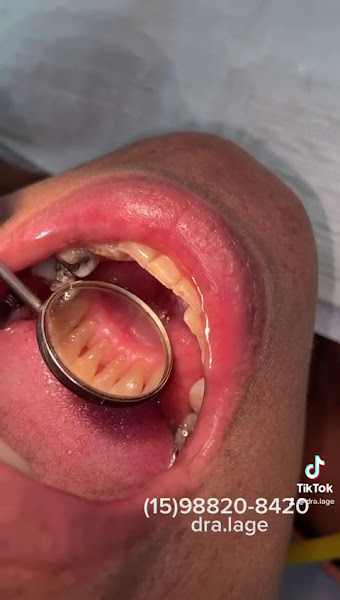 Foto 3 de Dentista - Dra. Vanessa Lage de Almeida