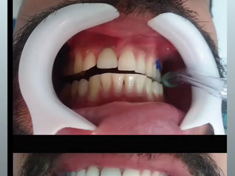 Foto 3 de Dentista - Dra. Vânia
