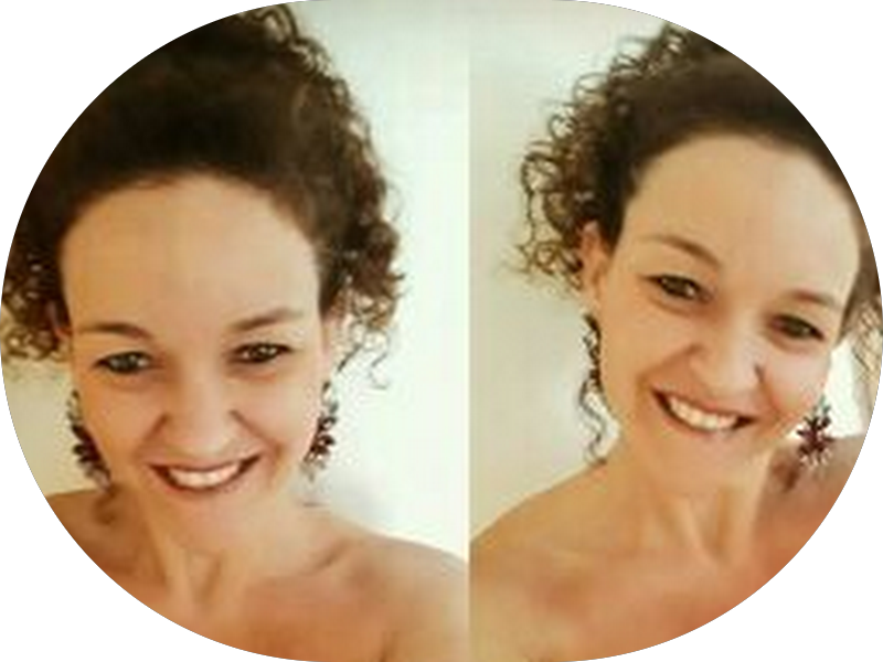 Foto 7 de Dentista e Invisalign Higienópolis - Clinica Odontológica GEN