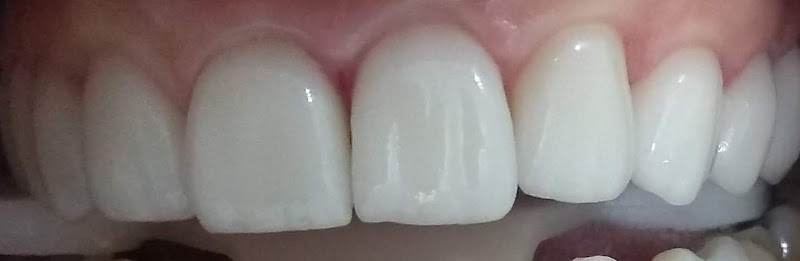 Foto 3 de Dentista Elisângela Ferreira Silva