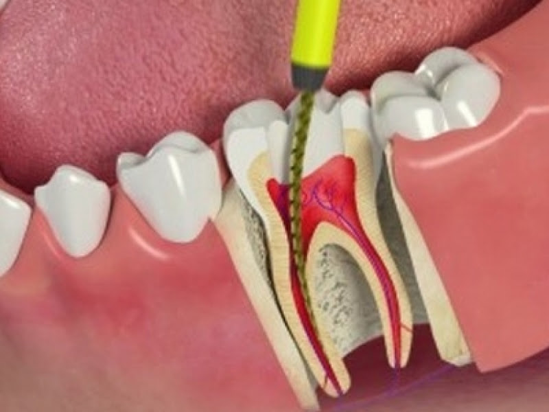 Foto 6 de Dentista em Americana - Bruno Moreira Odontologia