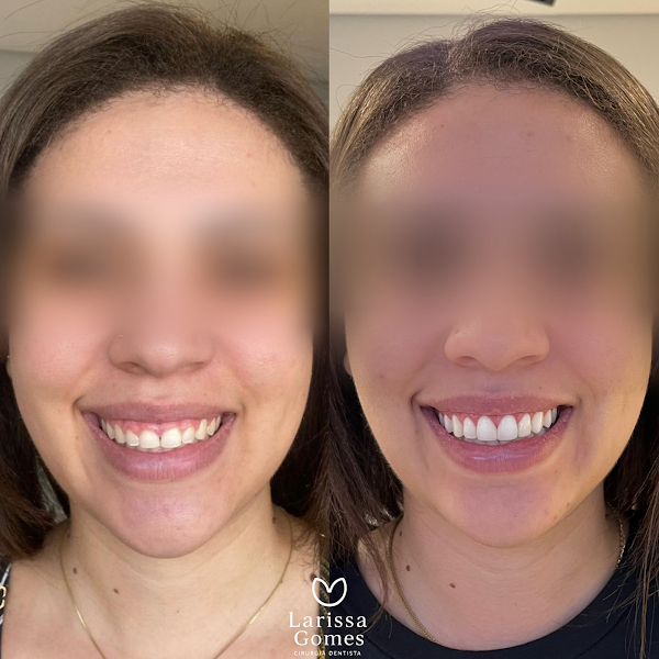 Foto 2 de Dentista em Bauru: Dra. Larissa Gomes