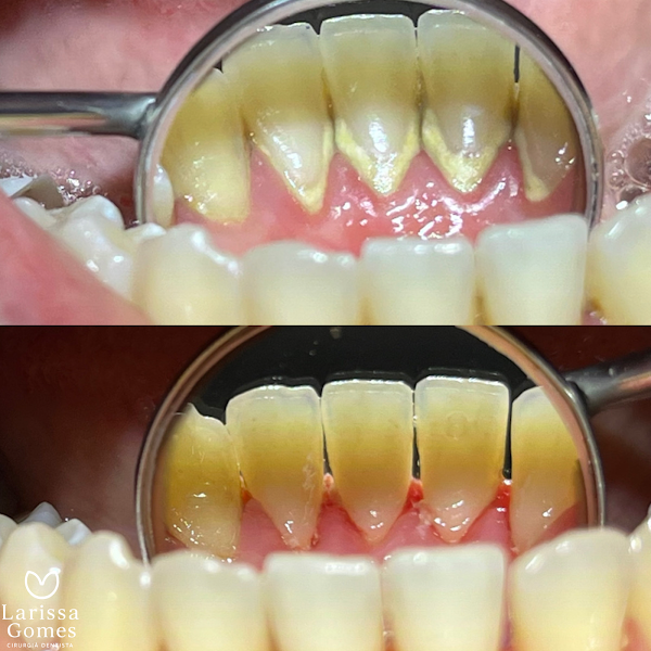 Foto 3 de Dentista em Bauru: Dra. Larissa Gomes