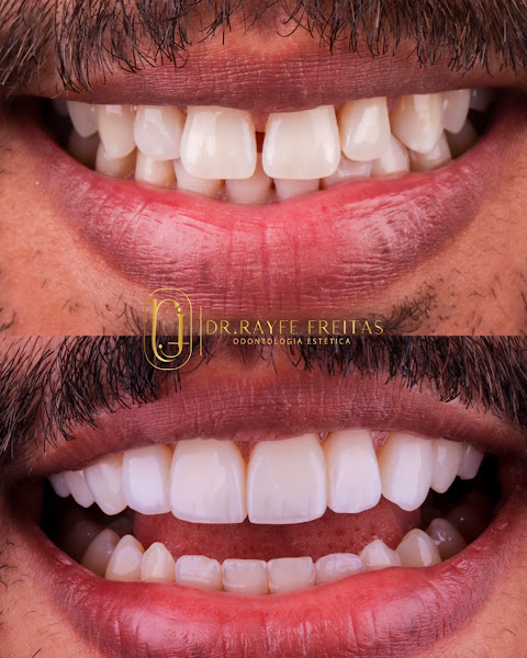 Foto 2 de Dentista em Belo Horizonte | Rayfe Freitas
