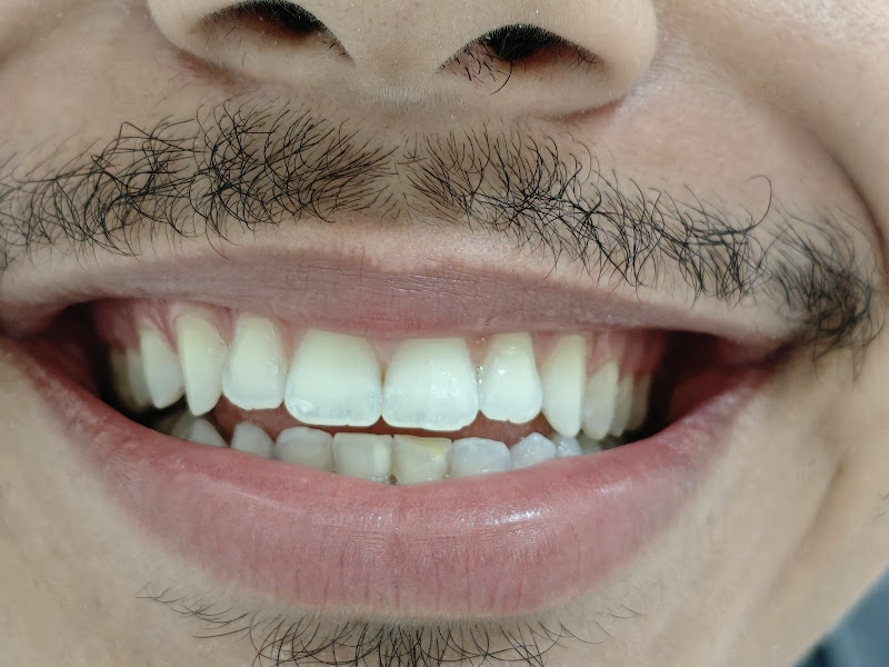 Foto 3 de Dentista em Carapicuiba - Dra. Sonydelane Rocha e Dr. Wilsonei Araújo