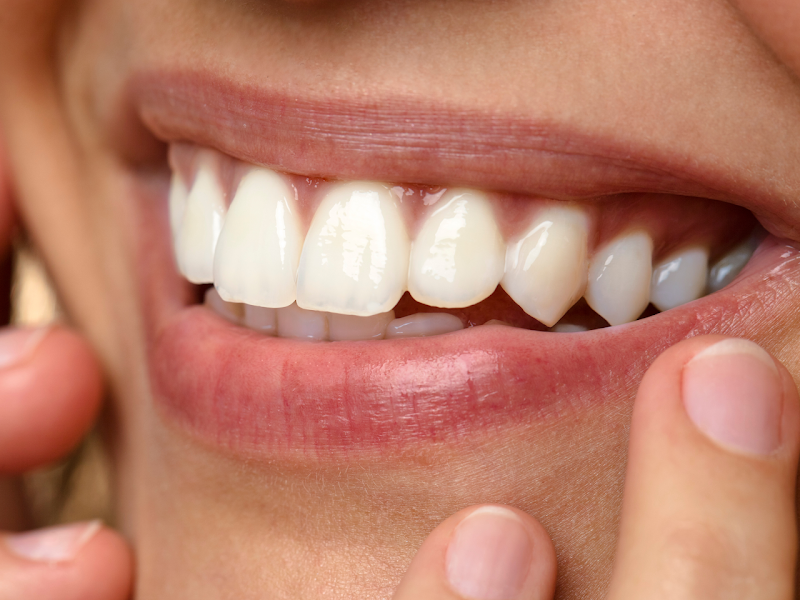 Foto 11 de Dentista em Caxias do Sul - Dental Vitta - Clínica Odontológica