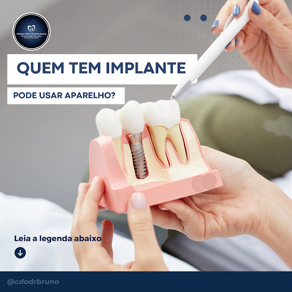 Foto 3 de Dentista em César de Souza.Dr. Bruno Éder Marcelino
