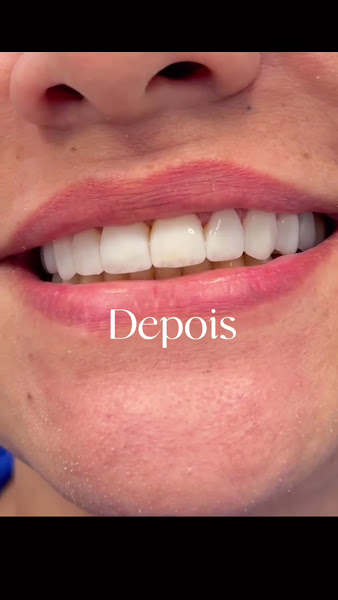 Foto 3 de Dentista em Cuiabá - Dra Mariana Lima Pereira