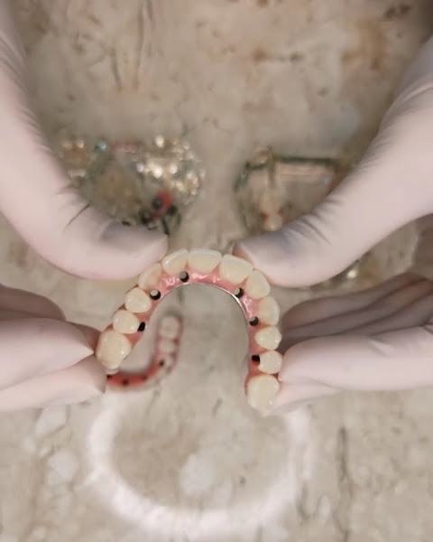 Foto 4 de Dentista em Cuiabá MT | Myrelief | Clínica Odontológica | Implante Dentário | Faceta dentária