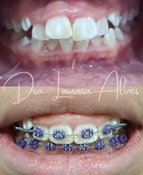 Foto 3 de Dentista em Duque de Caxias, RJ | Dra Larissa Alves