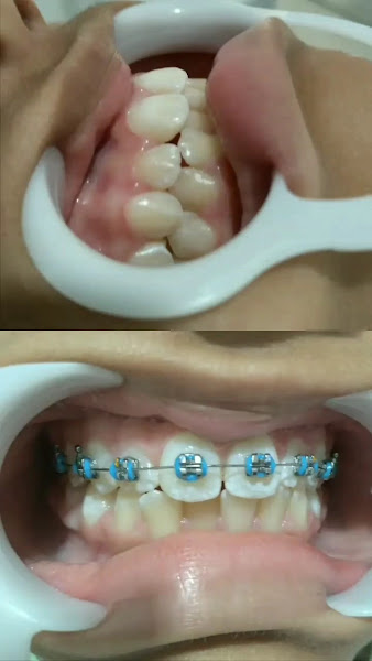 Foto 3 de Dentista em Guaratiba Fernanda Machado