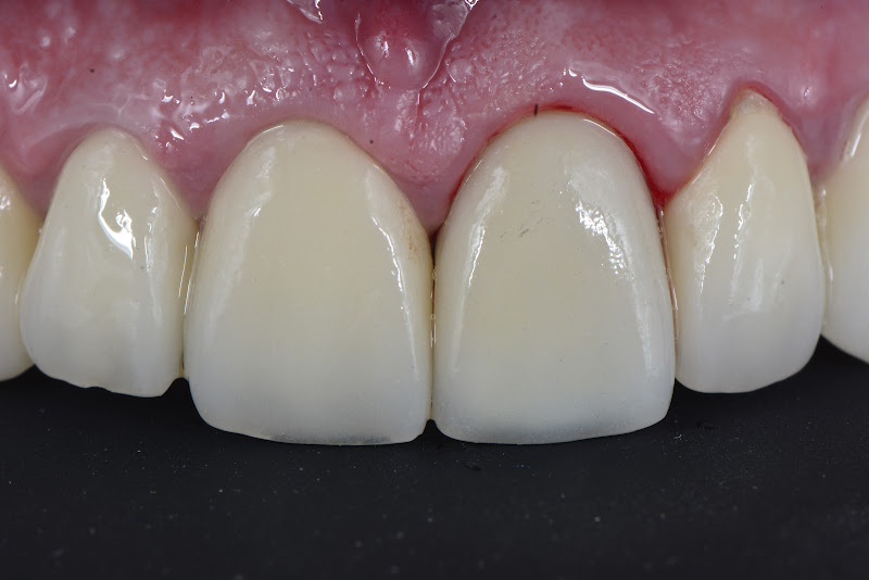 Foto 2 de Dentista em Icaraí | Niterói | Espaço Orofacial - Prótese - Implantes - Dentista Emergência 24h