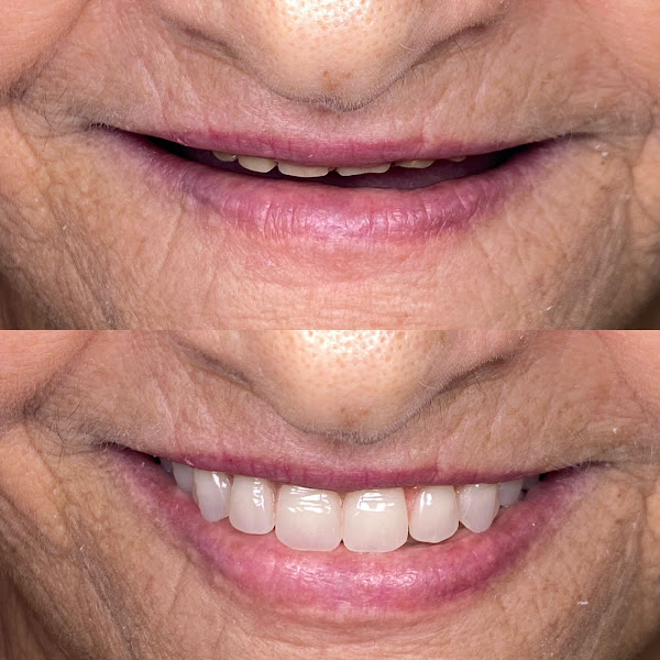 Foto 4 de Dentista em Ipatinga | Dra. Eduarda Quintanilha e Dra. Kátia Sabino