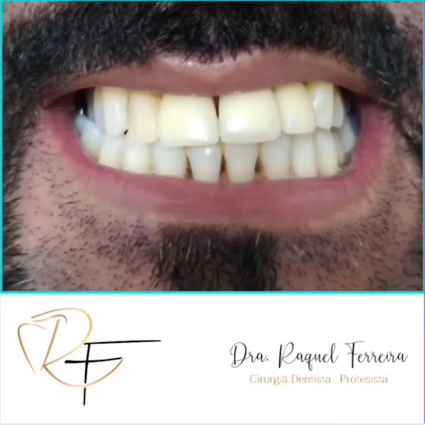 Foto 3 de Dentista Em Ipatinga Mg - Dra Raquel Ferreira