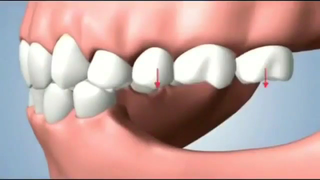 Foto 3 de Dentista em Jundiaí | Dra. Cinthia Campos | COE | Restauração | Canal | Ortodontia | Limpeza | Lente Dental | Clareamento