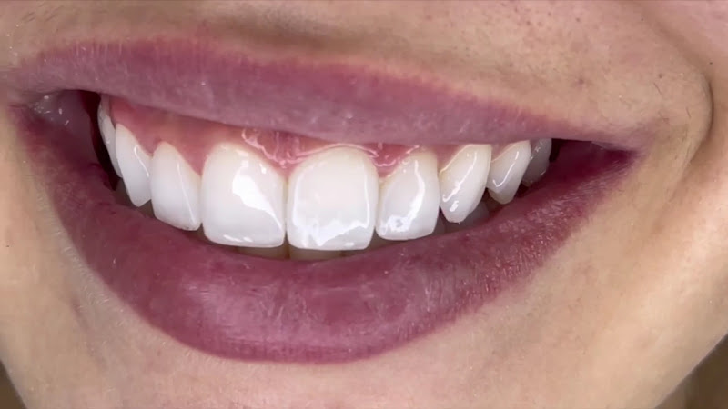 Foto 3 de Dentista em Marília Especialista em Facetas, Botox e Odontologia Estética | Dr. Randal Fadel