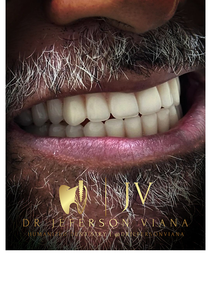 Foto 2 de Dentista em Nova Iguaçu | Dr Jeferson Viana | @drjefersonviana