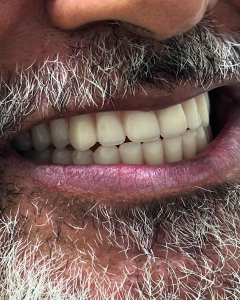 Foto 3 de Dentista em Nova Iguaçu | Dr Jeferson Viana | @drjefersonviana
