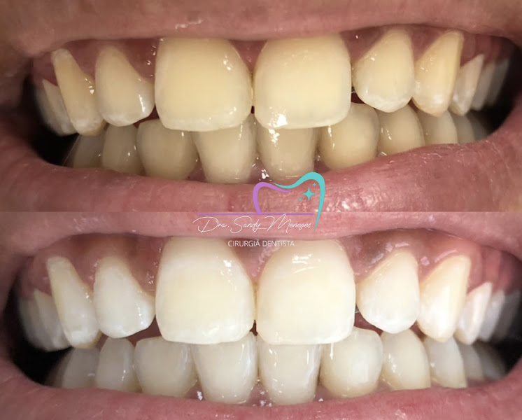 Foto 2 de Dentista em Osasco - Dra. Sandy Menezes
