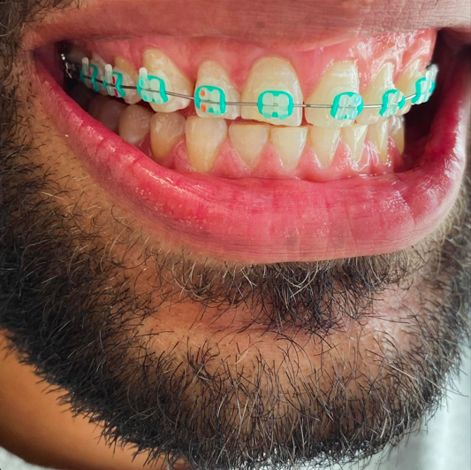 Foto 2 de Dentista em Perus - Dra. Thaisa Lima | Clinico Geral, Estética e Pediatria