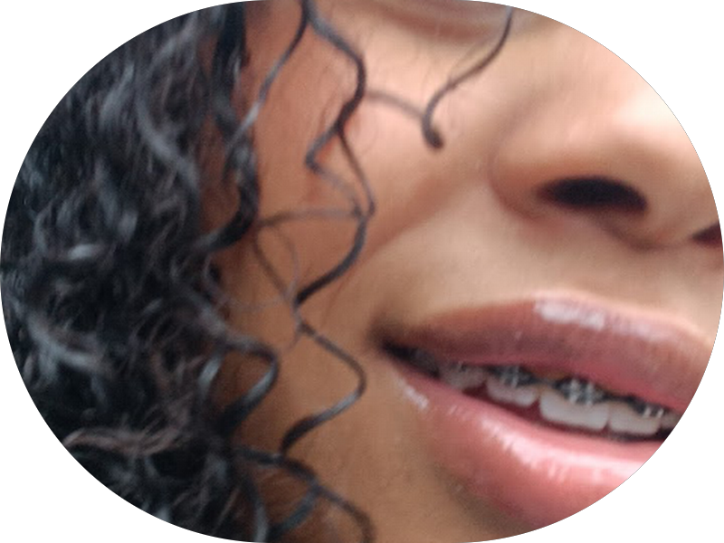 Foto 4 de Dentista em Perus - Dra. Thaisa Lima | Clinico Geral, Estética e Pediatria