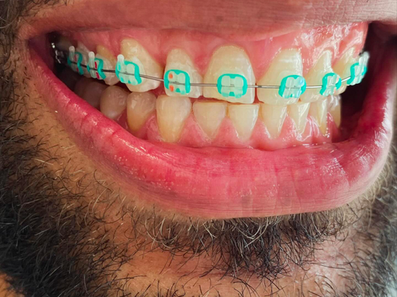 Foto 8 de Dentista em Perus | Dra. Vanessa Costa | São Paulo