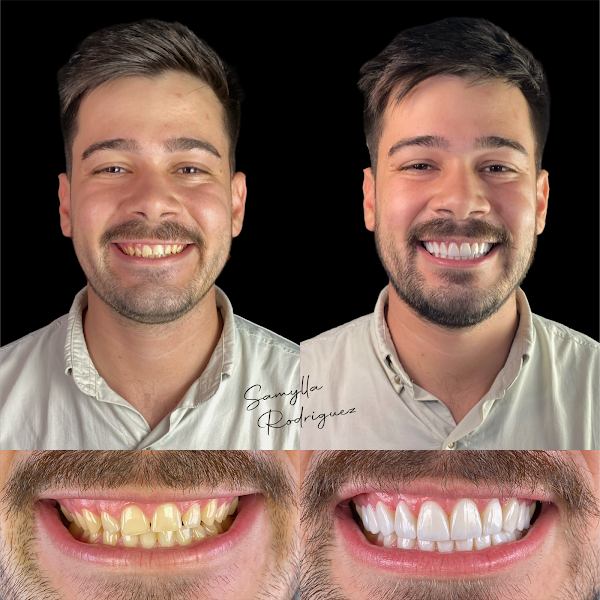 Foto 2 de Dentista em Petrolina - Samylla Rodriguez