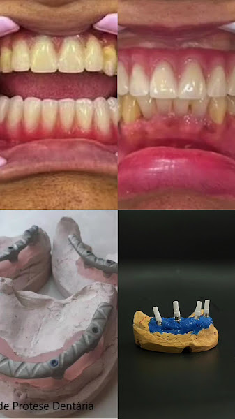 Foto 3 de Dentista em Pirituba Dr. Vinícius Felix , Implantodontista/Clinica Geral .