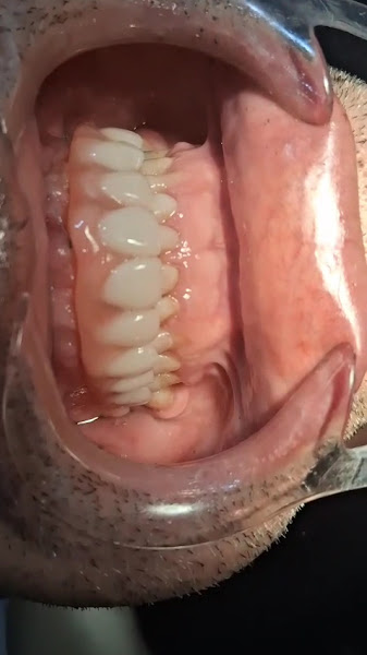 Foto 4 de Dentista em Pirituba Dr. Vinícius Felix , Implantodontista/Clinica Geral .