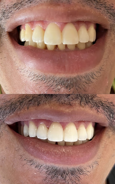 Foto 2 de Dentista em Recife - Dra. Thallyta Maia